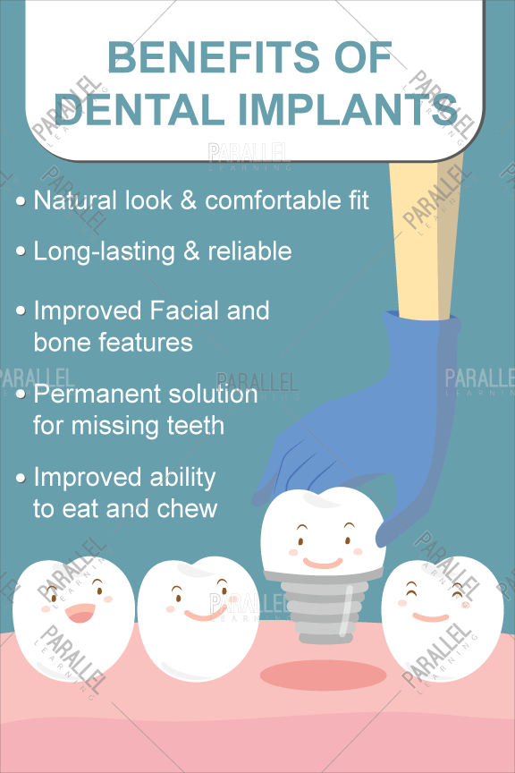 Benefits of Dental Implants - Parallel Learning